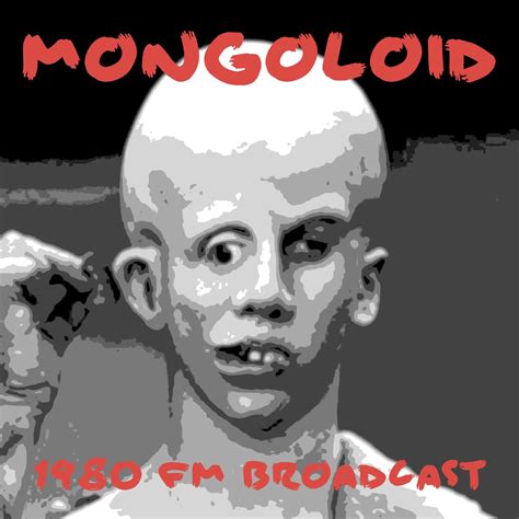 Mongoloid